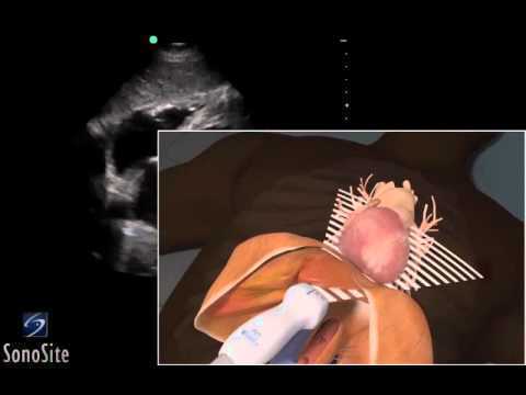 See video