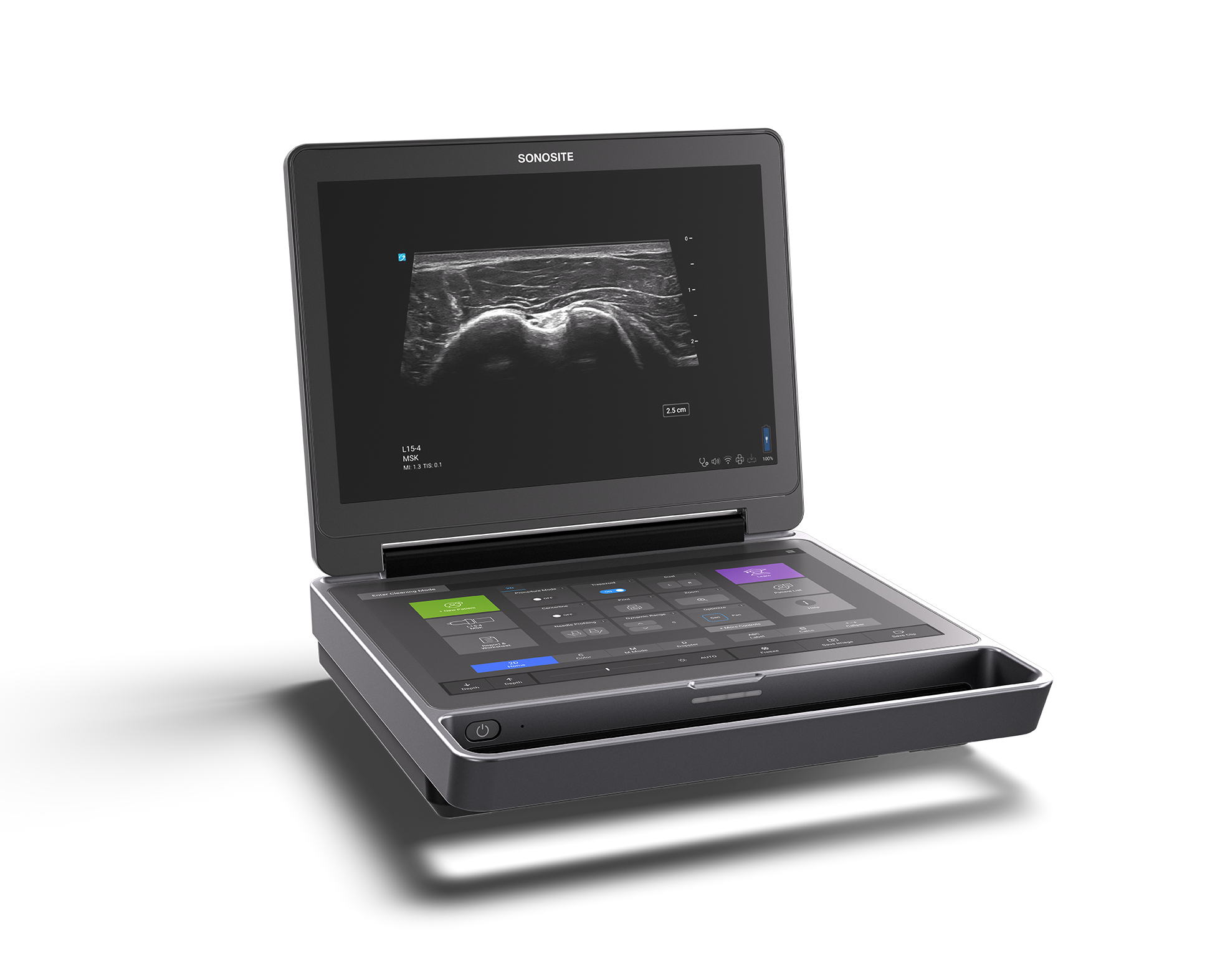 Sonosite MT