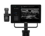 Sonosite iLOOK