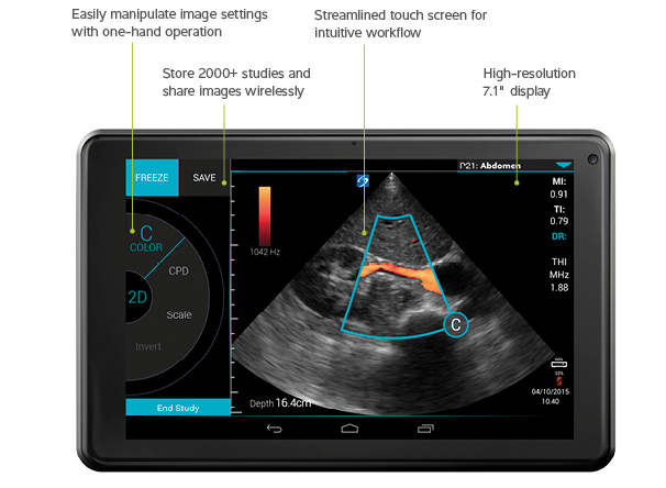 The Sonosite iViz