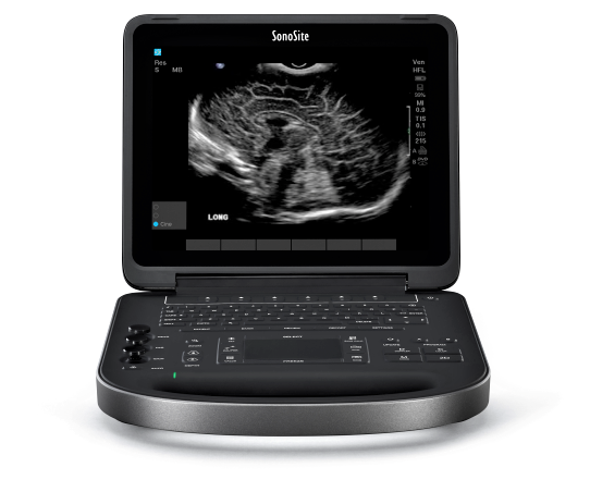 Sonosite EdgeII