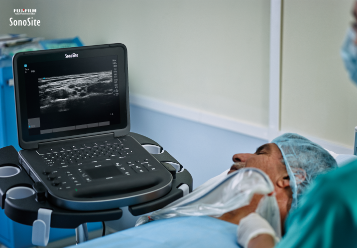 Edge II Ultrasound Machine