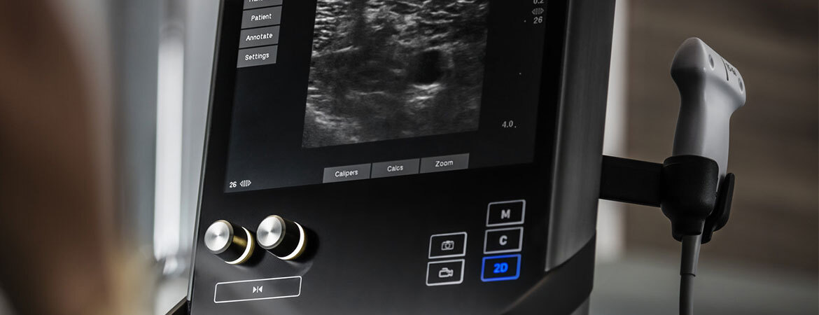 Scanning with a Sonosite S II