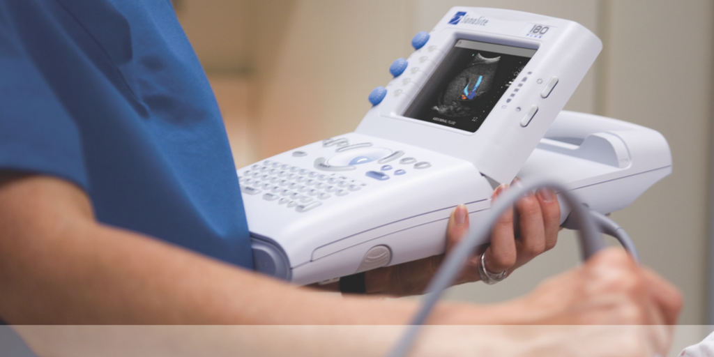 Sonosite 180 portable ultrasound system