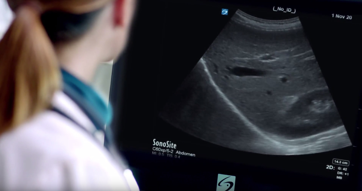 Why choose a Sonosite ultrasound machine? 