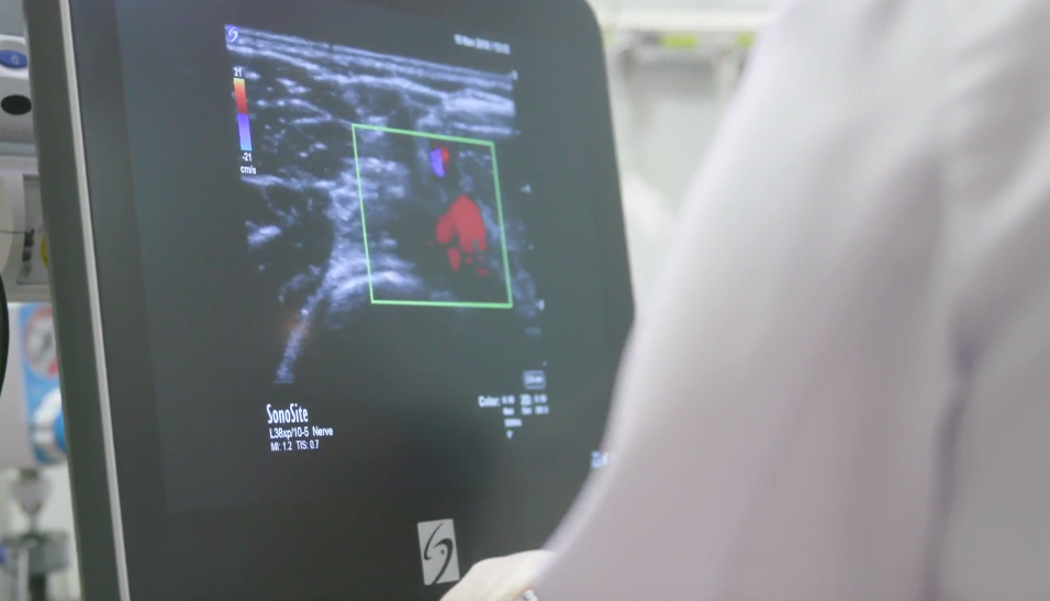 Sonosite KLAS report