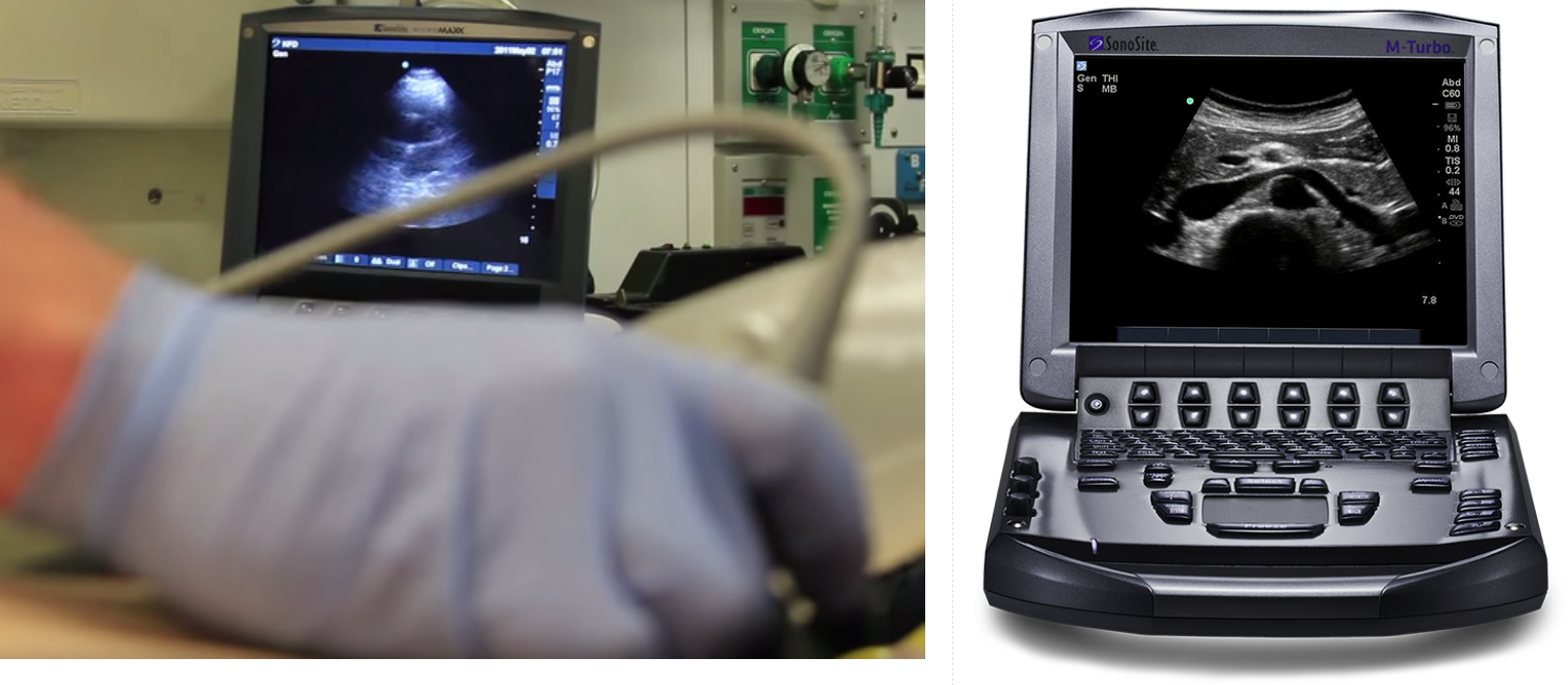 Sonosite M-Turbo