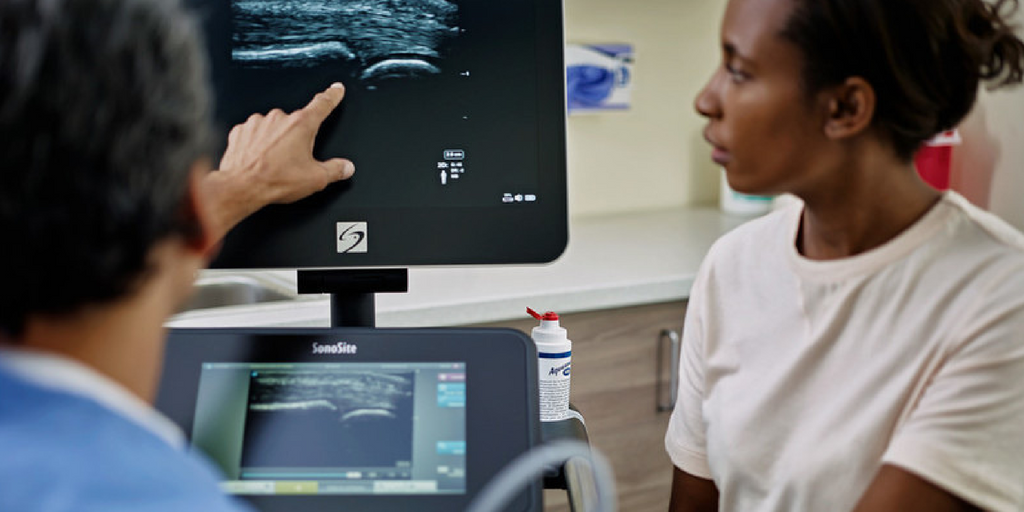 Sonosite products