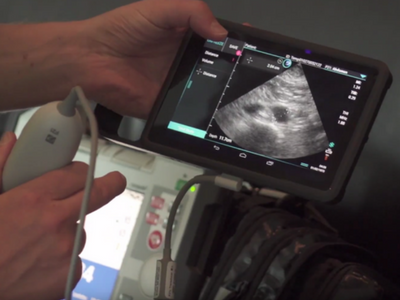 Sonosite ultrasound systems ease of use