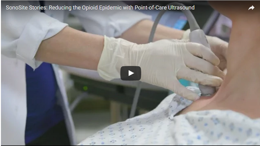 Reducing the Opiod Epidemic