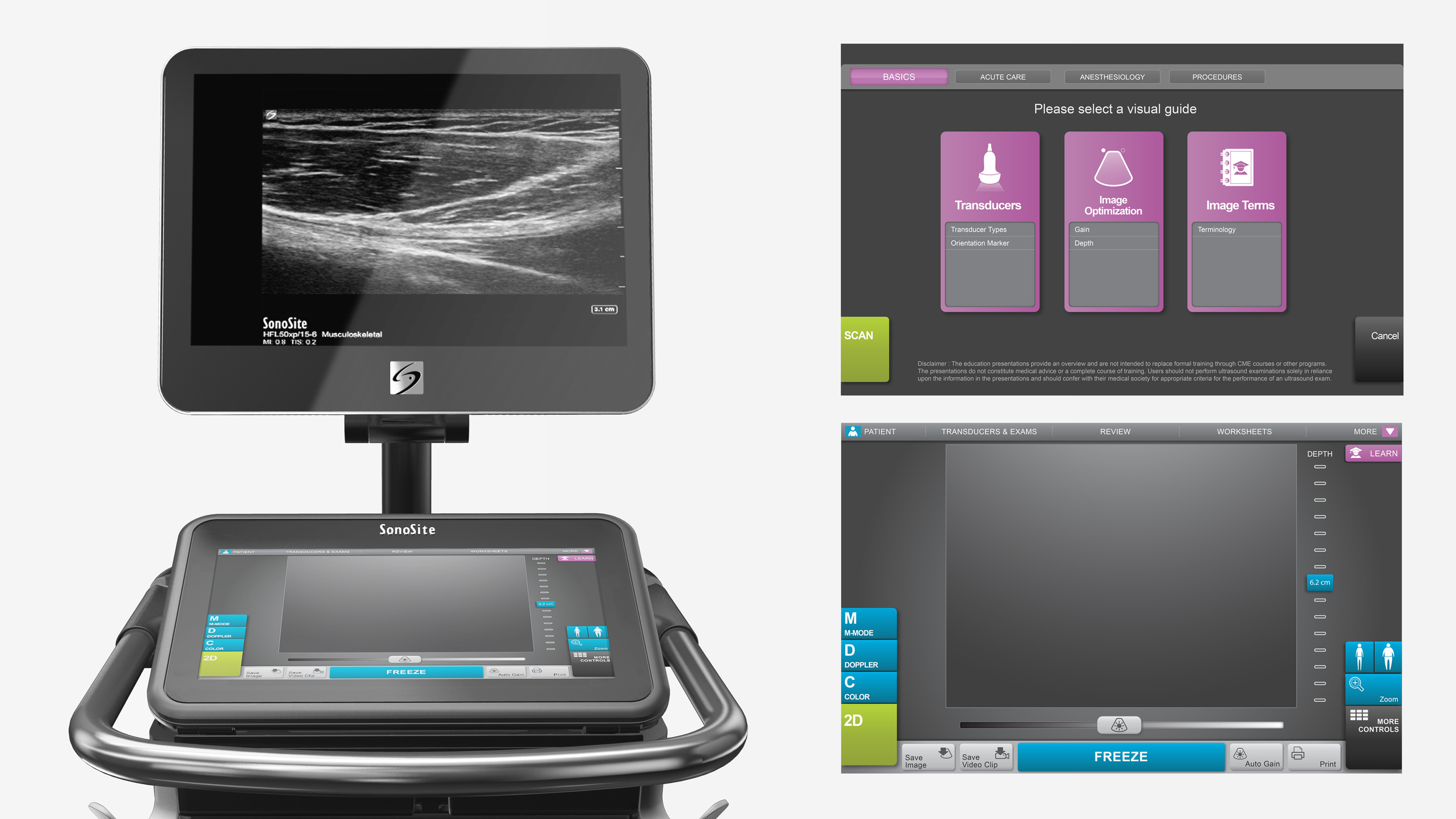 The Sonosite X-Porte