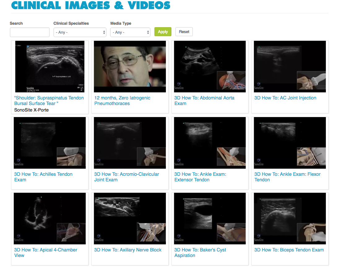 Sonosite's clinical media gallery 