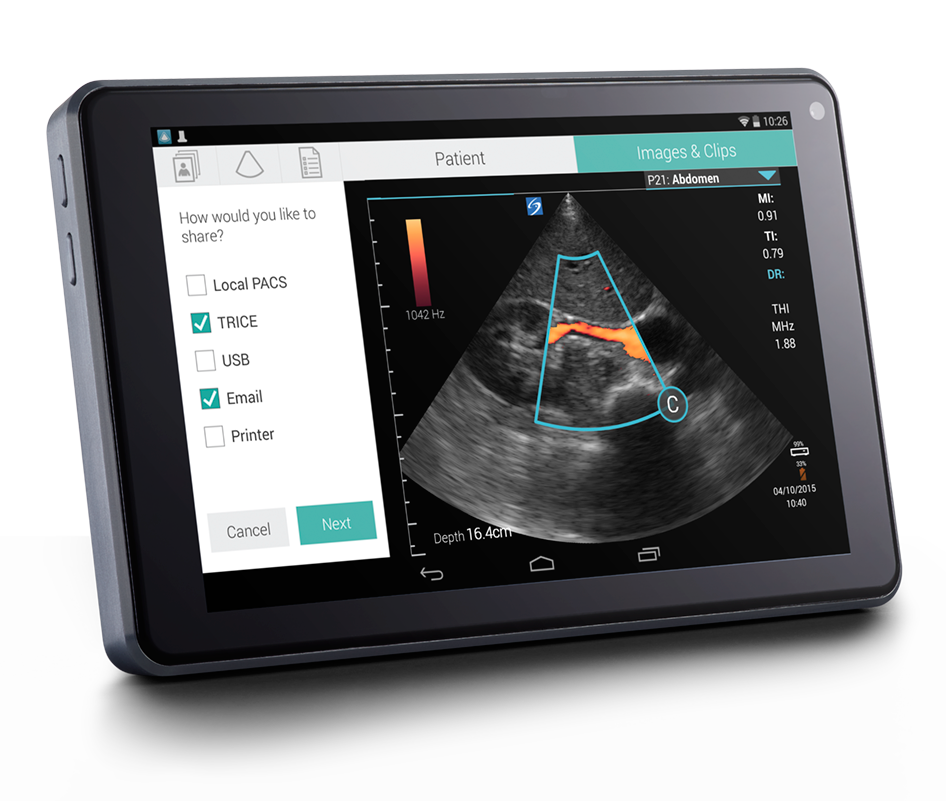 Sonosite iViz