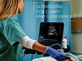 portable ultrasound machines