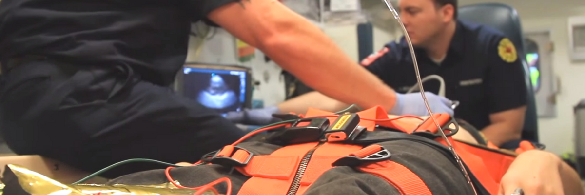 Sonosite ease of use
