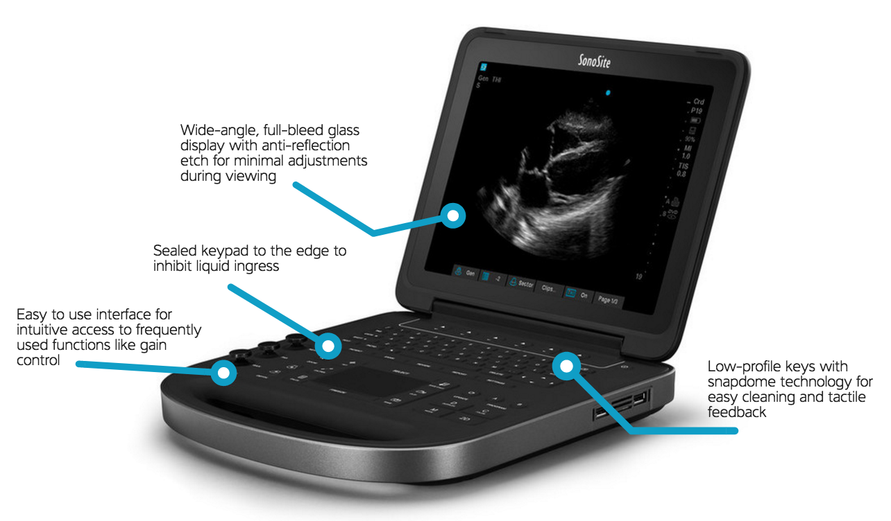 Sonosite Edge II