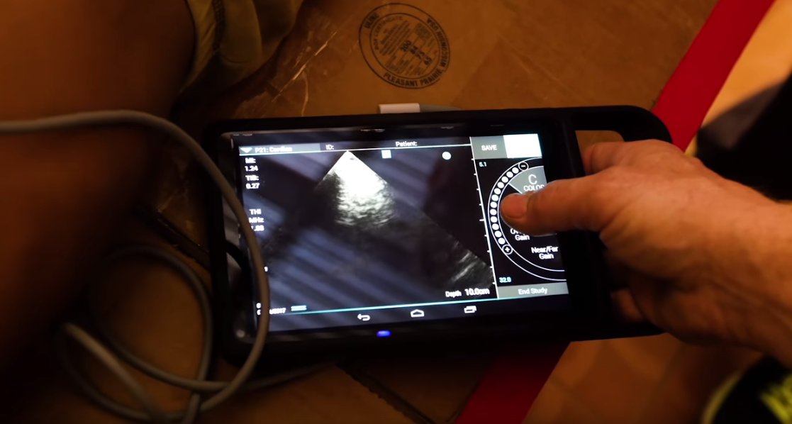Sonosite iViz