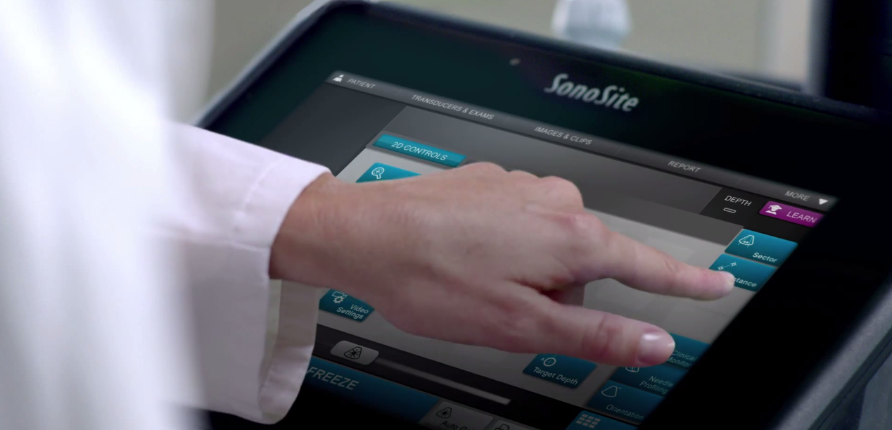 Sonosite Ultrasound Machine
