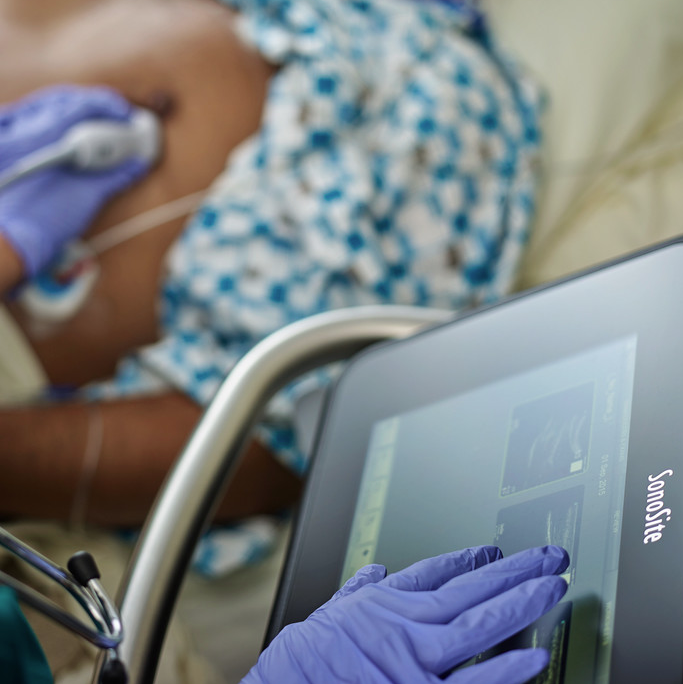 Sonosite ease of use