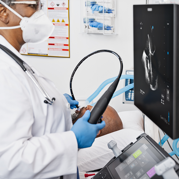 经食管超声检查