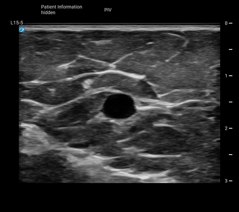 L15-5 PIV Basilic V Trv