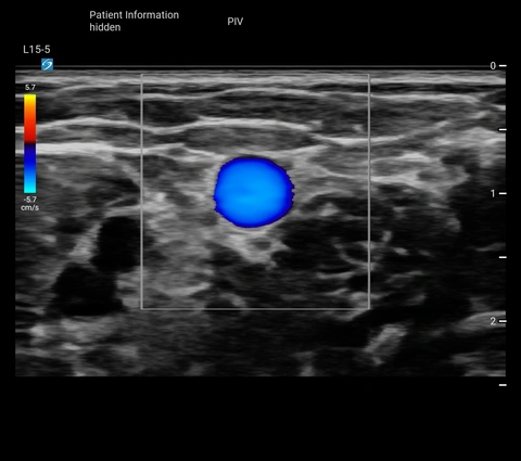 L15-5 PIV Basilic V Trv