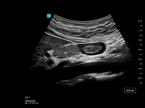 ST C5-1 Abdomen Gastric Antrum Long