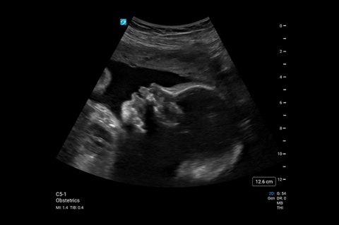 PX_C5-1 Obstetrics PX_C5-1 Obstetrics