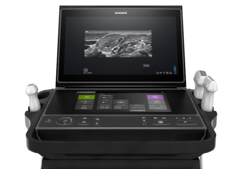 Sonosite ZX Closeup Front