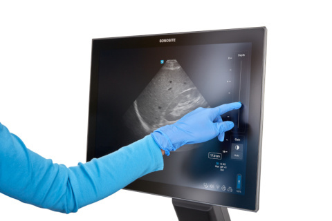 Sonosite LX System Hand P5-1 Abdomen RUQ