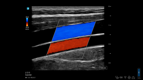 ZX - L12-3 - Carotid - Jugular - Color