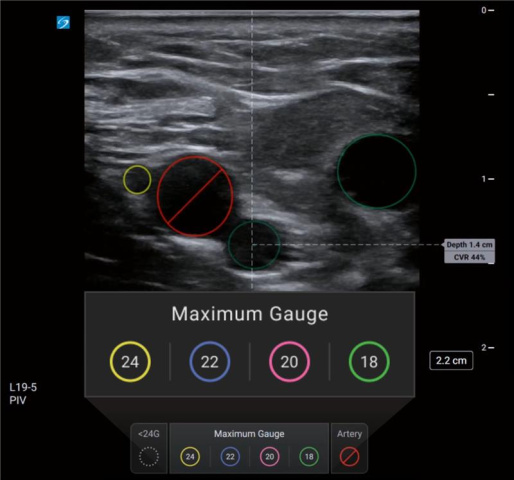 Collaborate With Us on Advancing POCUS AI