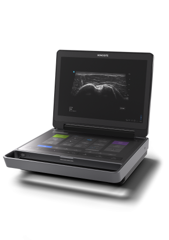 Sonosite MT