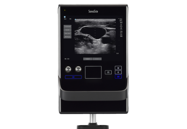 Sonosite SII