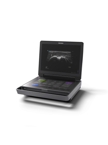Sonosite MT