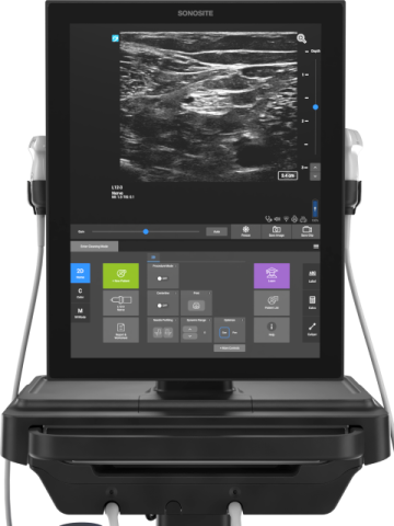 Sonosite ST