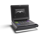 Sonosite MT
