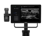 Sonosite iLOOK
