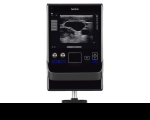 Sonosite SII