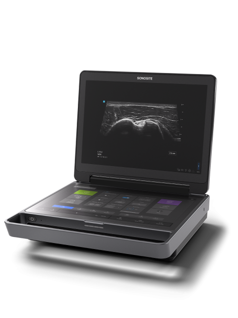 Sonosite MT