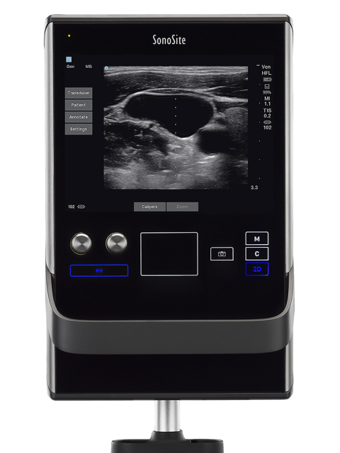 Sonosite SII