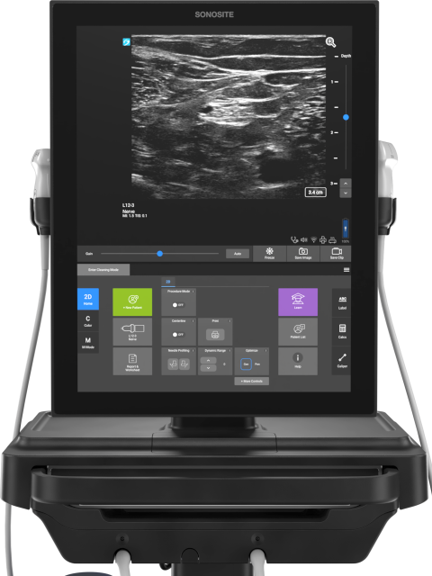 Sonosite ST