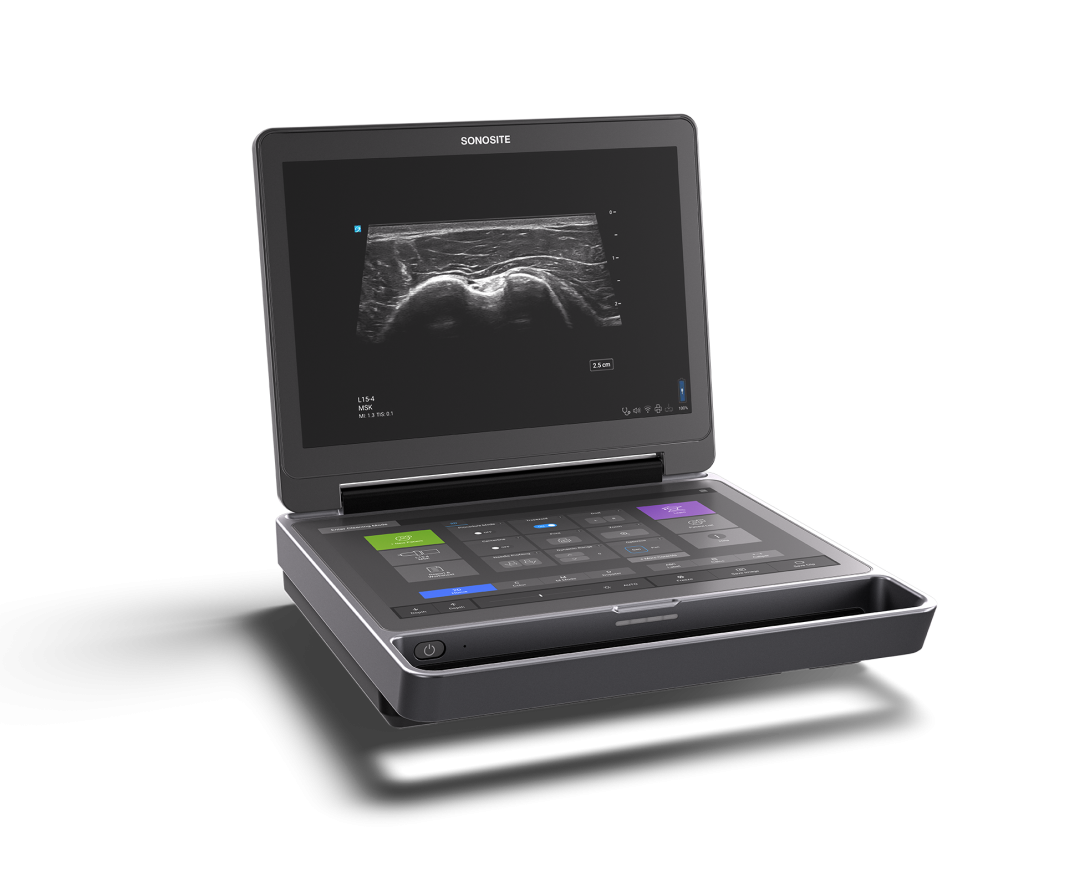 Sonosite MT Sonosite MT